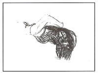 Glândula Supra-renais - Exercício 5 Glândula Supra-renais - Exercício 5